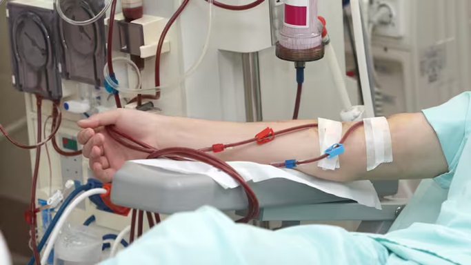 Aantal niertransplantaties in Nederland piekt